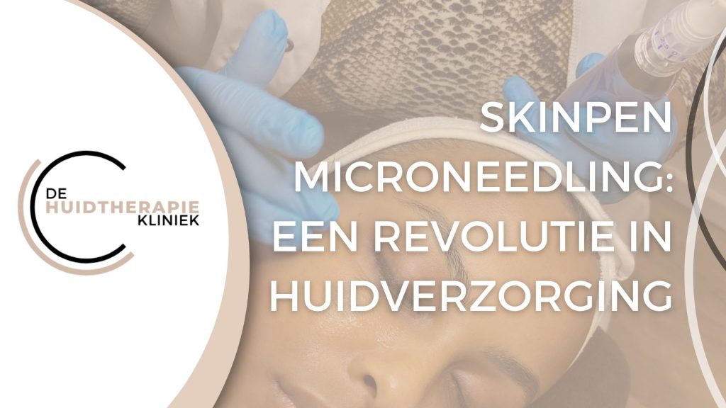 Skinpen Microneedling Een revolutie in huidverzorging