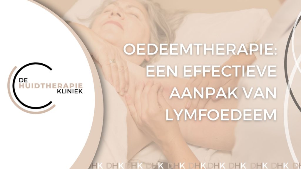 Oedeemtherapie: Een effectieve aanpak van Lymfoedeem