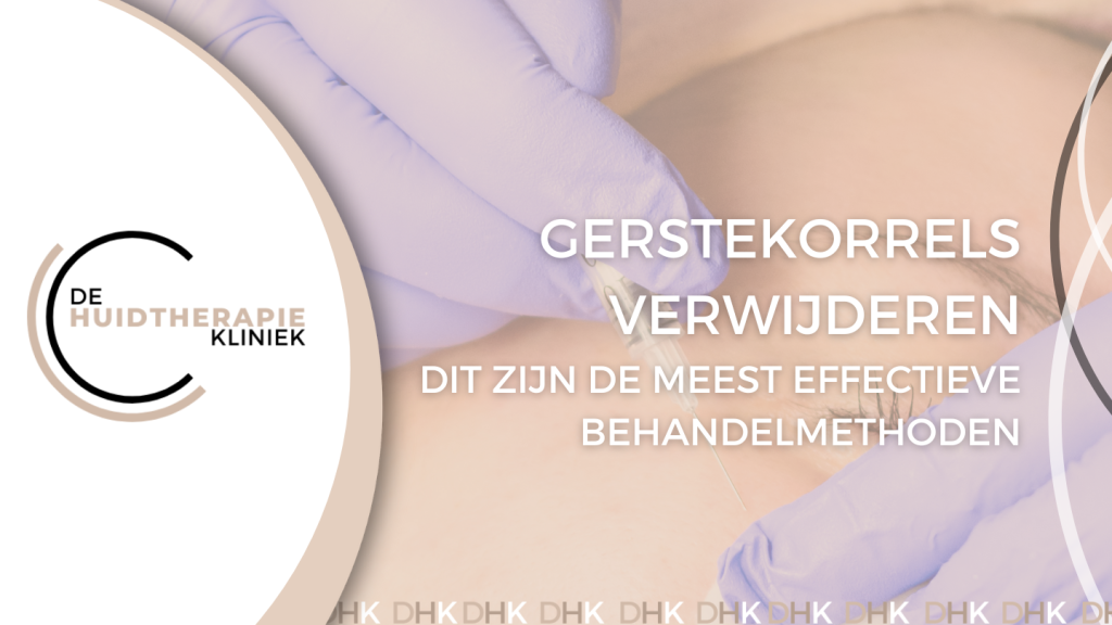 Gerstekorrels verwijderen