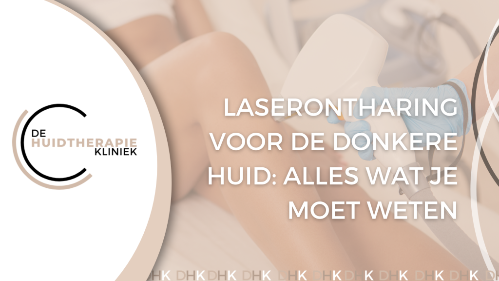 laserontharing voor de donkere huid