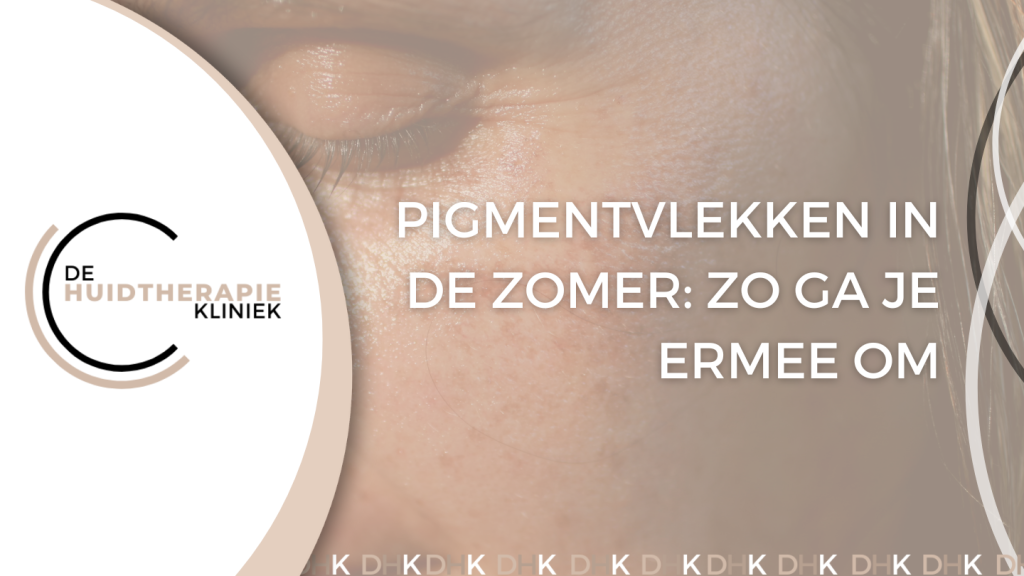 pigmentvlekken in de zomer
