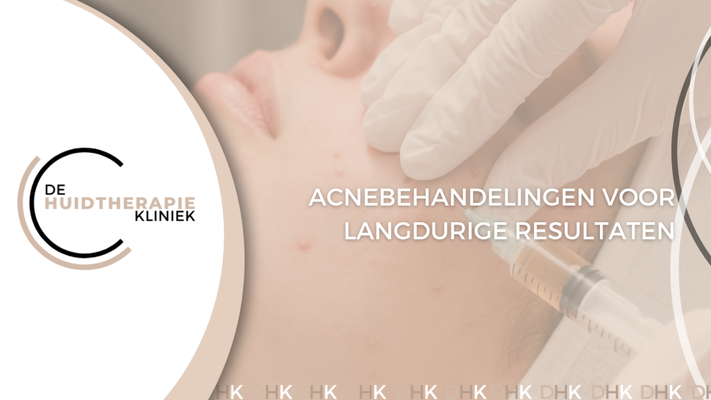 Acnebehandelingen voor langdurige resultaten