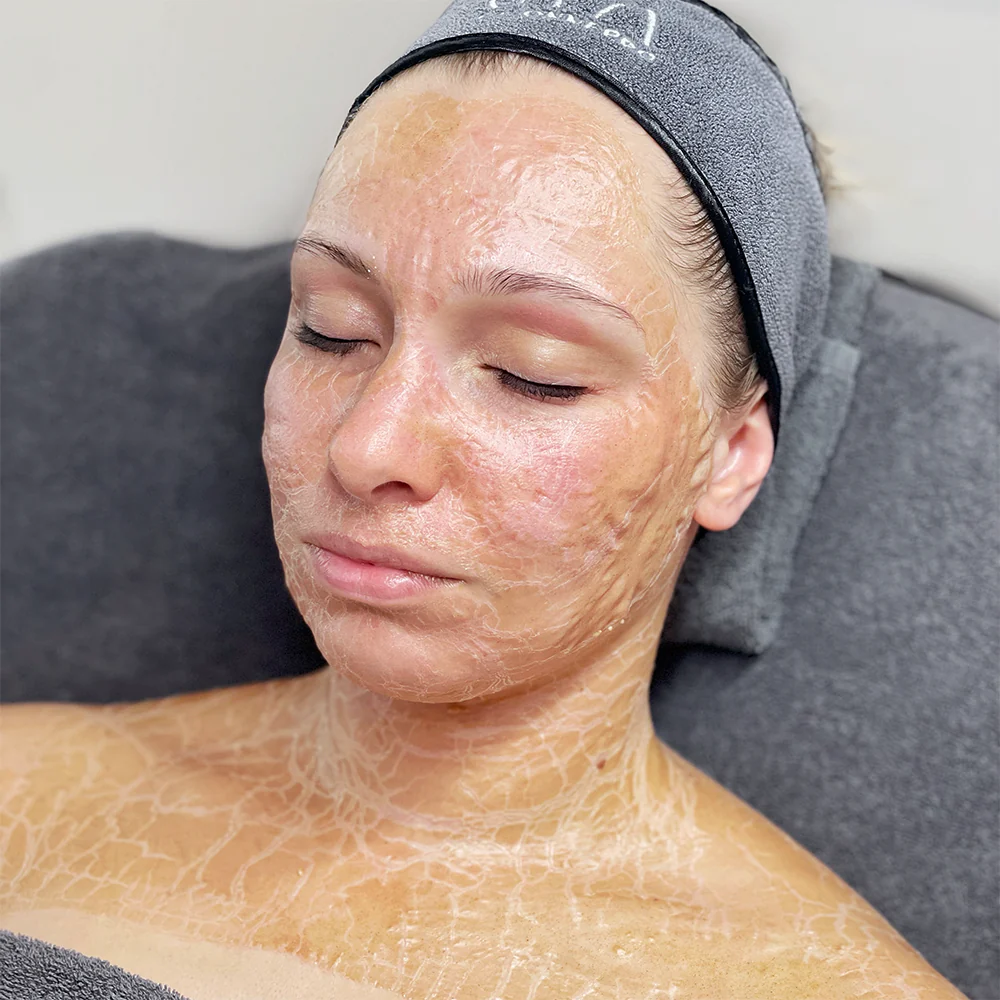 bio pusle therapy masker intrekken