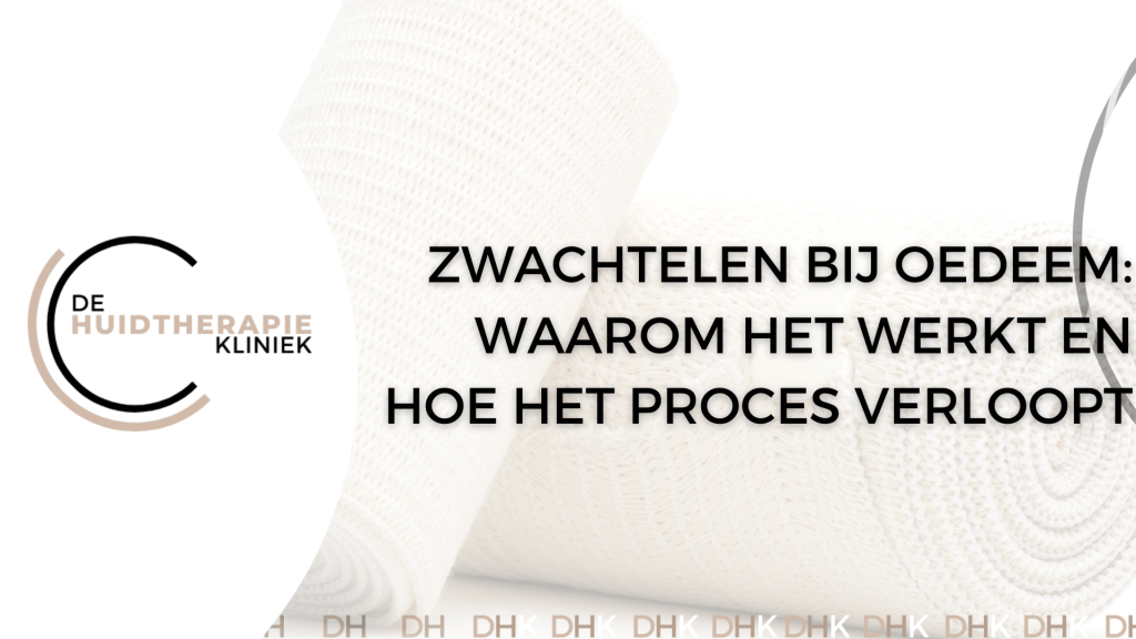 Zwachtelen bij oedeem