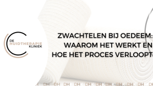 Zwachtelen bij oedeem