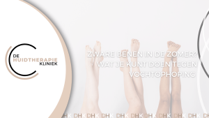 Zware benen in de zomer?