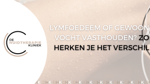 Lymfoedeem of vocht vasthouden?